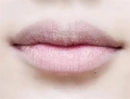 图片细节